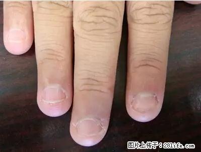 剪指甲、挖耳屎，这些日常小动作竟隐藏大危害！ - 黔东南生活资讯 - 黔东南28生活网 qdn.28life.net